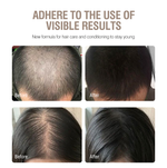 KooSwalla - Anti Hair Loss Shampoo 500ml 2