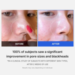 medicube-Zero Pore Pad 2.0, 70pad